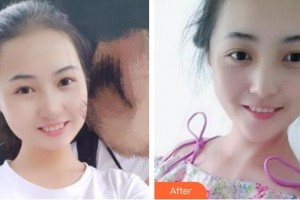 上海保加医疗美容门诊部王丽珊整形价格表附冷光美白案例展示