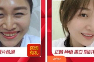 合肥丽人女子医院中韩整形美容中心季媛梅 教授整形价格表附美白牙齿案例展示