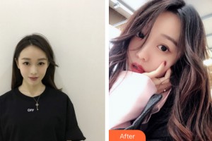 武汉伊丽莎白医疗美容诊所余祝君整形价格表附皮肤美容案例展示