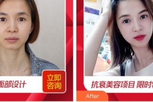 唐山联合丽珍医疗美容门诊部金承泰整形价格表附埋线提升案例展示